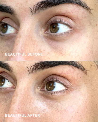 Tula Glow + Get It - Cooling & brightening eye balm - A caffeine-powered eye balm that brightens tired eyes