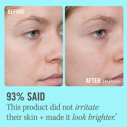 Suero iluminador con vitamina C al 10 % de First Aid Beauty