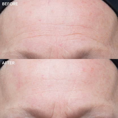 Algenist GENIUS Ultimate Anti-Aging Vitamin C+ - Líneas finas, manchas de la edad y decoloración para revelar un tono de piel más brillante, radiante y uniforme 