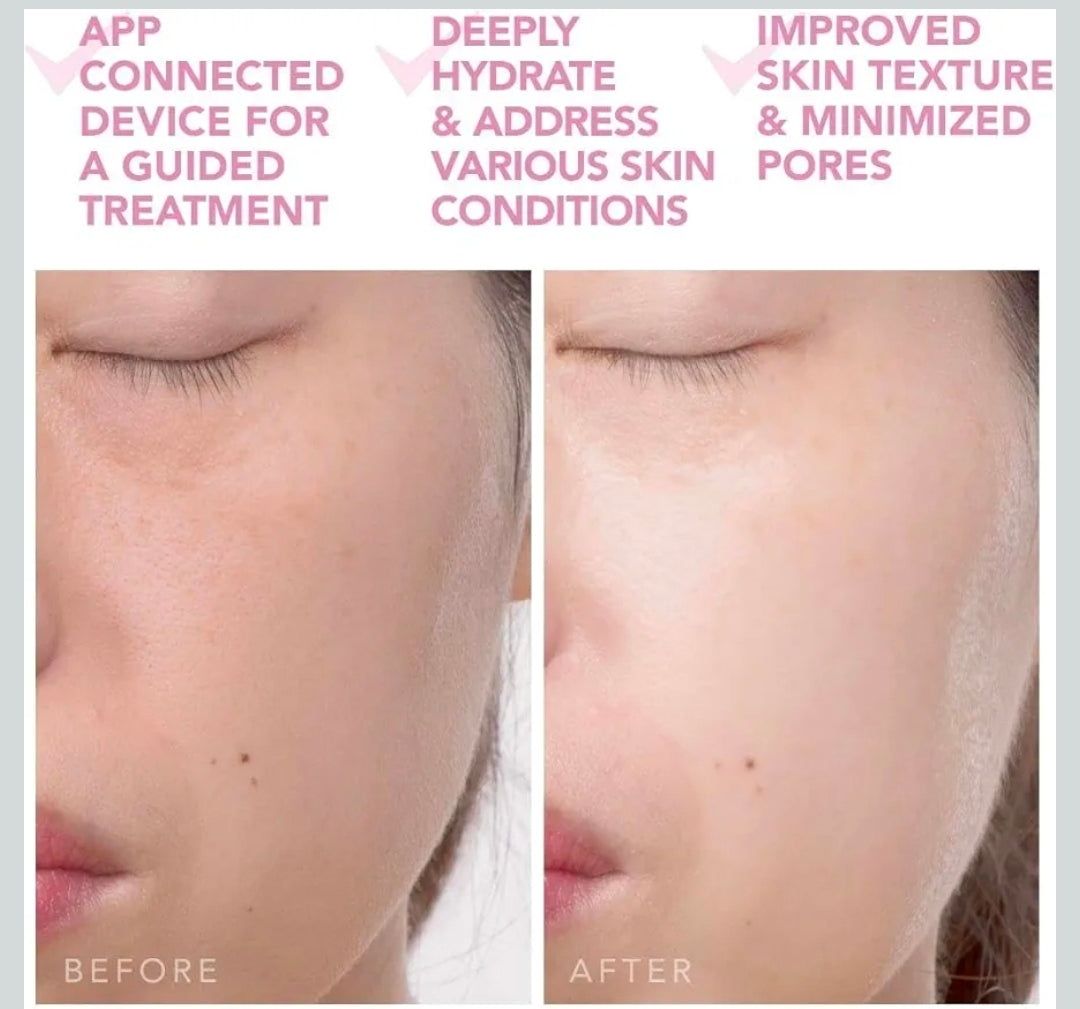 Foreo UFO 2 - Swedish Beauty Tech Power Mask - Supercharged LED Cooling/Warming 1 min Face Treatment - Microcurrent Face Moisturizer - Dark Spot & Acne Scar Treatment for Face - Anti Aging – Nourishing - Pearl Pink