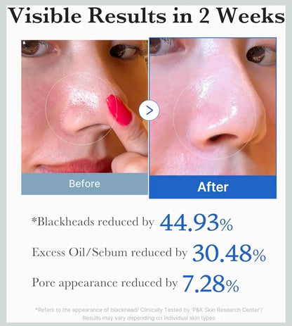 Almohadillas tónicas medicube Zero Pore Pad 2.0: almohadilla facial de doble textura para exfoliación y cuidado de los poros con 4,5 % de ácido láctico AHA y 0,45 % de ácido salicílico BHA.