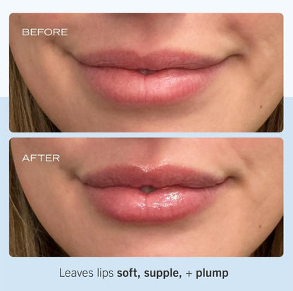 First Aid Beauty Ultra Repair Lip Balm - Instant Hydration and Moisture for Soft, Supple & Plump Lips, Concentrated Formula of Botanical Oils, Butters & Waxes