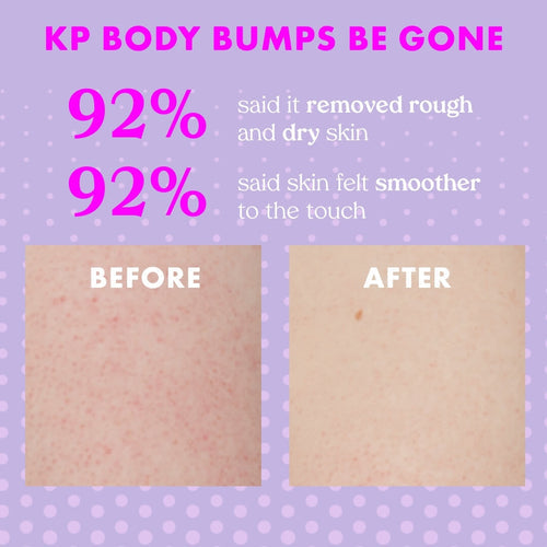 Exfoliante Kopari KP Body Bumps Be Gone