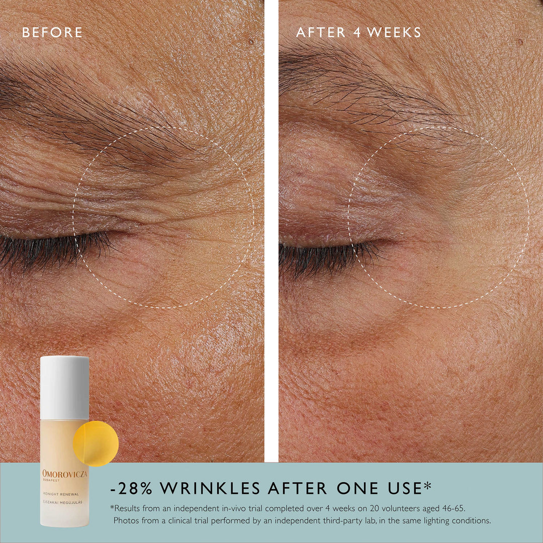 Omorovicza Midnight Renewal - Advanced overnight serum with Retinal and Bio Retinoid Mediterranean Microalgae to deliver visible results by morning