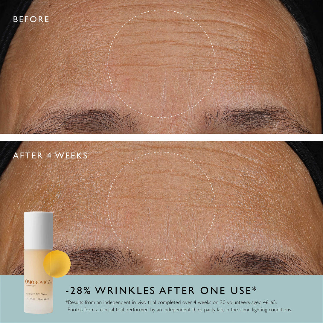 Omorovicza Midnight Renewal - Advanced overnight serum with Retinal and Bio Retinoid Mediterranean Microalgae to deliver visible results by morning