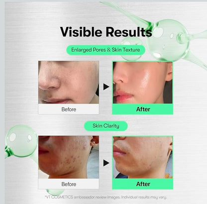 VT COSMETICS CICA Reedle Shot 100 - Spicule Microneedling Serum for Pore Care & Exfoliation, Exosome, Centella Asiatica for Glass Skin, Skin Texture, Korean Liquid Skin Booster (1oz)