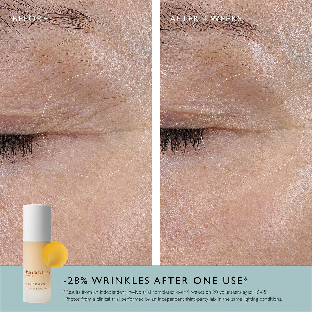 Omorovicza Midnight Renewal - Advanced overnight serum with Retinal and Bio Retinoid Mediterranean Microalgae to deliver visible results by morning