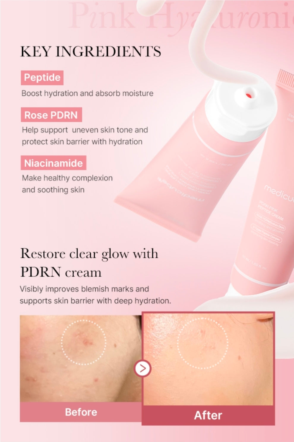 medicube PDRN Pink Peptide Cream - PDRN Hyaluronic Moisturizing Cream - Blemish Recovery, Relief & Hydrating Care, Restores Skin Elasticity & Glow, Evens Skin