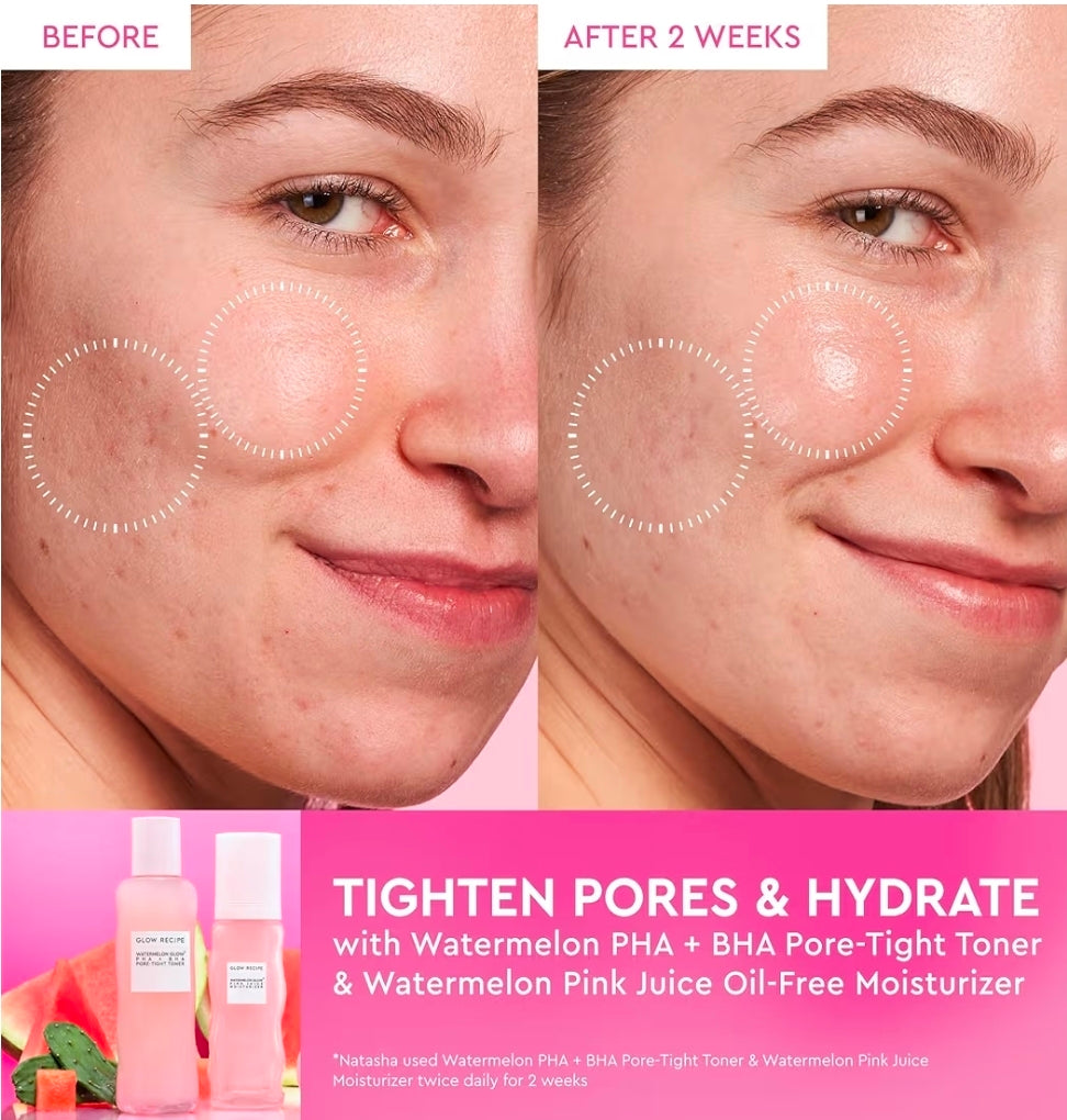 Tónico facial Glow Recipe PHA + BHA: minimizador de poros y exfoliante facial suave para reafirmar, hidratar y exfoliar. Glicerina, agua de sandía y cactus.