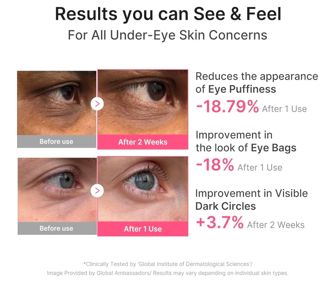 medicube PDRN Pink Caffeine Collagen Eye Patch - Gel Eye Patches for the appearance of Dark Circles, Undereye Bags, Firming, Age-Defying Care with Retinol, Collagen