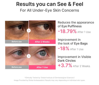 medicube PDRN Pink Caffeine Collagen Eye Patch - Gel Eye Patches for the appearance of Dark Circles, Undereye Bags, Firming, Age-Defying Care with Retinol, Collagen