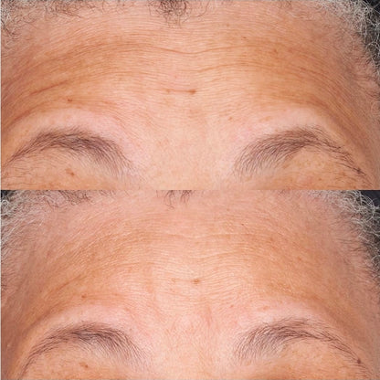 Perricone MD Hypoallergenic Clean Correction Barrier Repair Nourishing Moisturizer: humectante eficaz que mejora el aspecto de la elasticidad de la piel al tiempo que suaviza la apariencia de líneas y arrugas.