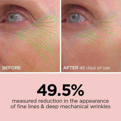 BeautyBio R45 The Reversal - Retinol Anti-Aging Treatment Set - 45 Days Multi-Phase Retinol Treatment - Skin Cell Turnover - Tightening, brightening and smoothing patented 3-phase retinol booster treament