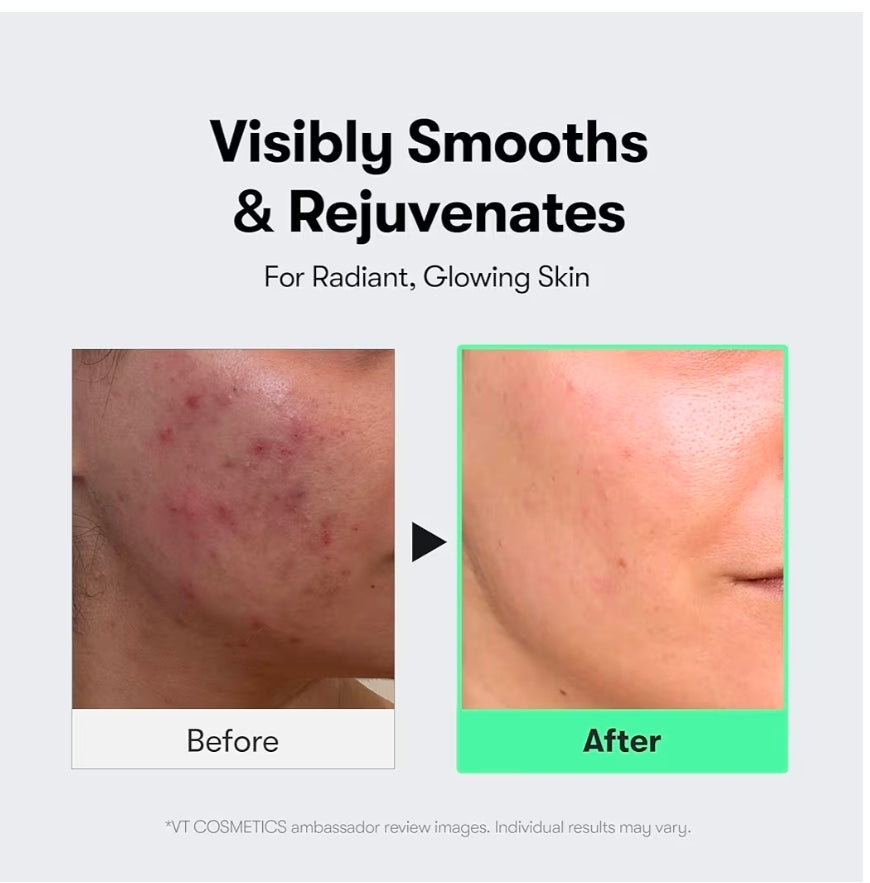 VT COSMETICS CICA Reedle Shot 300 Serum - Advanced Night Exosome, Microneedling Serum, Centella Asiatica, Hyaluronic Acid, Propolis, Soft Skin, Regeneration, Glass Skin