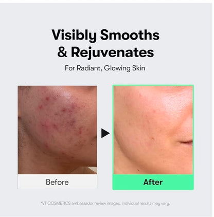 VT COSMETICS CICA Reedle Shot 300 Serum - Advanced Night Exosome, Microneedling Serum, Centella Asiatica, Hyaluronic Acid, Propolis, Soft Skin, Regeneration, Glass Skin