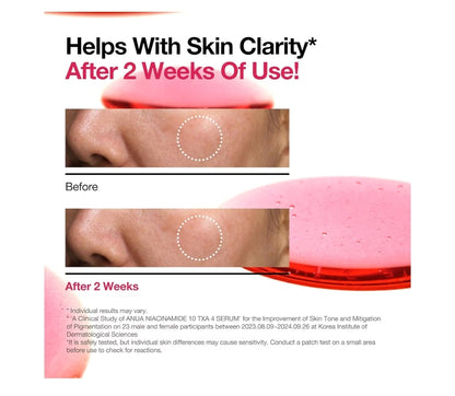 ANUA Niacinamide 10 + TXA 4 Serum, Hyaluronic Acid, Tranexamic Acid, Facial Serum for Glass Skin, Clarifying, Radiant Complexion with Natural Color