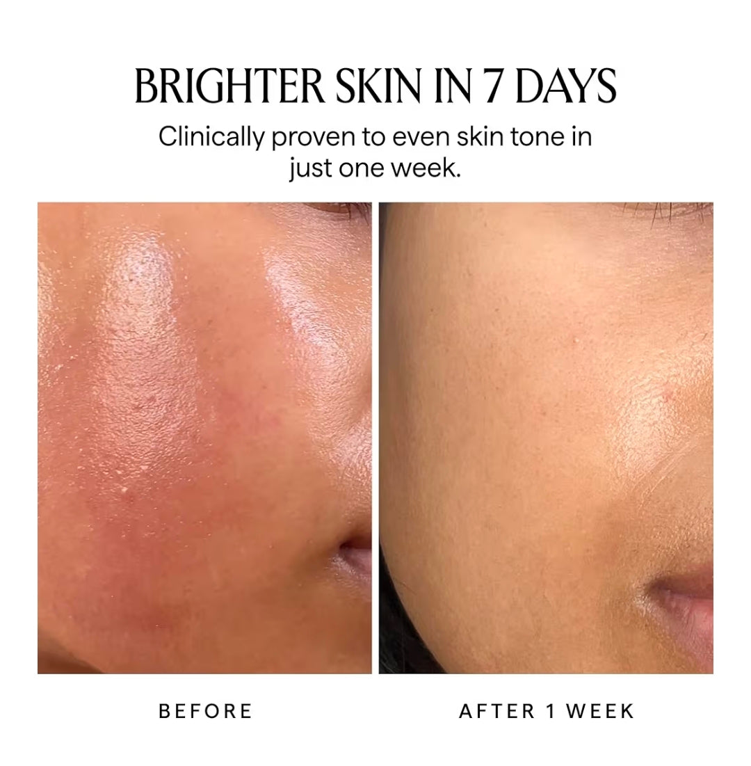 HERBIVORE Nova 15% Vitamin C + Turmeric Brightening Serum - For Dark Spots, Hyperpigmentation + Even Skin Tone, Vegan, Plant-Based, Cruelty-Free