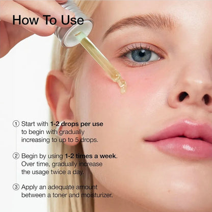 Anua Azelaic Acid 10 Hyaluron Redness Soothing Serum, Facial Serum for Troubled & Sensitive Skin, Breakouts, Hyaluronic Acid, Niacinamide, Spot Care, Natural Color