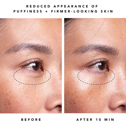 Herbivore Dew 1% Bakuchiol + Peptides Retinol Alternative Firming Eye Cream - Fine lines and wrinkles, Loss of firmness, Dryness, Signs of aging around the eyes