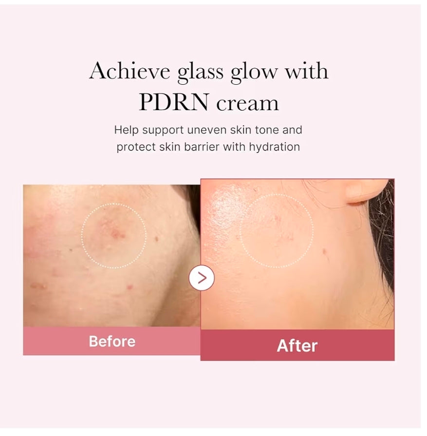 medicube PDRN Pink Peptide Cream - PDRN Hyaluronic Moisturizing Cream - Blemish Recovery, Relief & Hydrating Care, Restores Skin Elasticity & Glow, Evens Skin