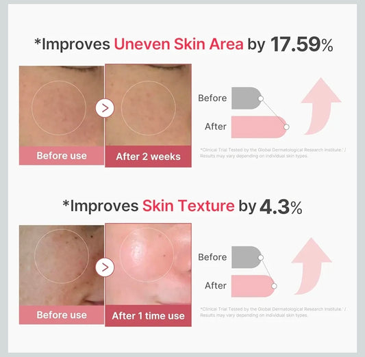 medicube PDRN Pink Collagen 2,000 PPM Spicule - Liquid Skin Booster Exosome, Salmon DNA Spicules, Uneven Skin Tone, Pore Care, Skin Texture