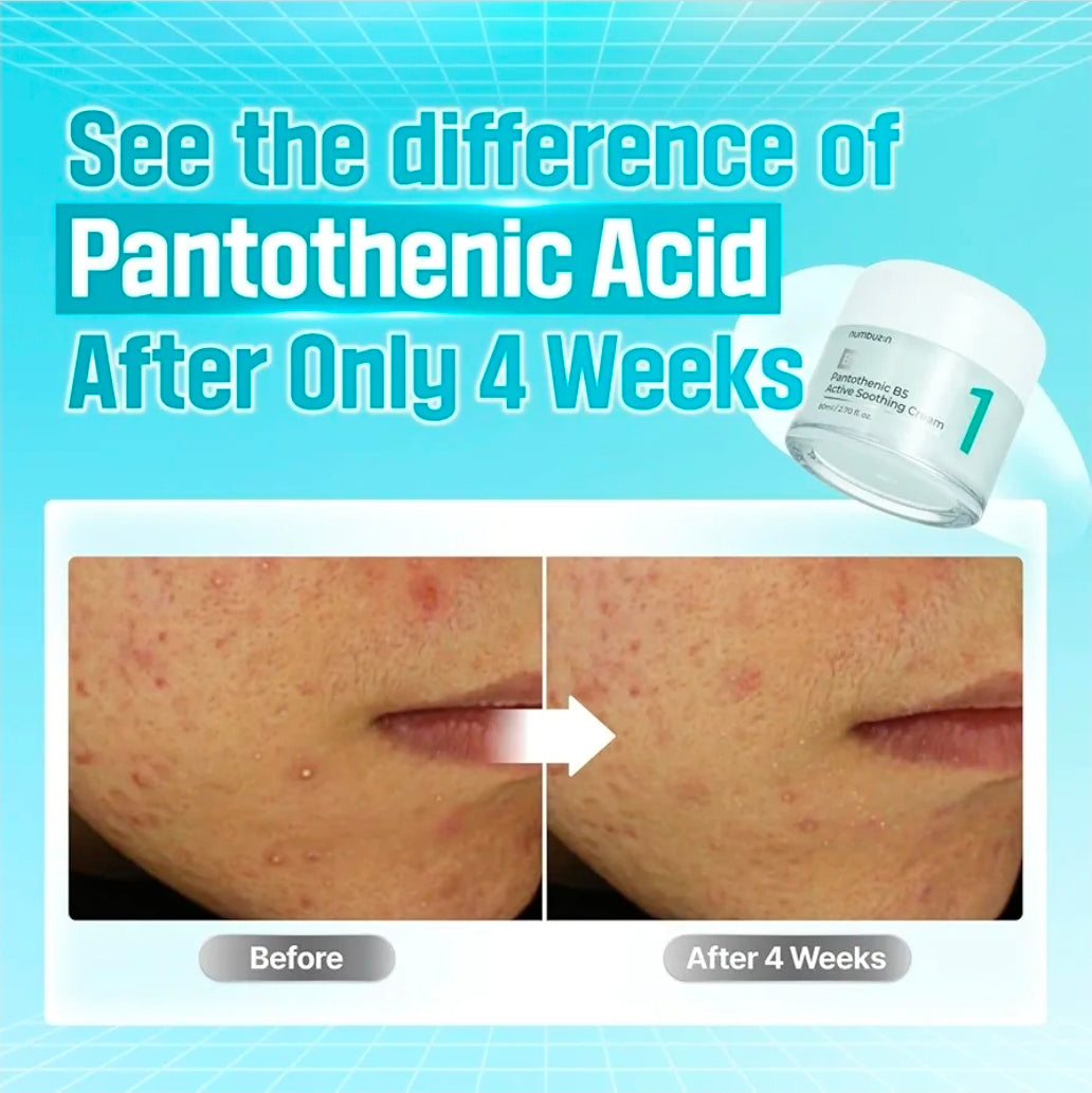 Crema calmante activa con ácido pantoténico B5 Numbuzin n.° 1: elimina el sebo y los problemas de la piel. Formulada para pieles grasas.