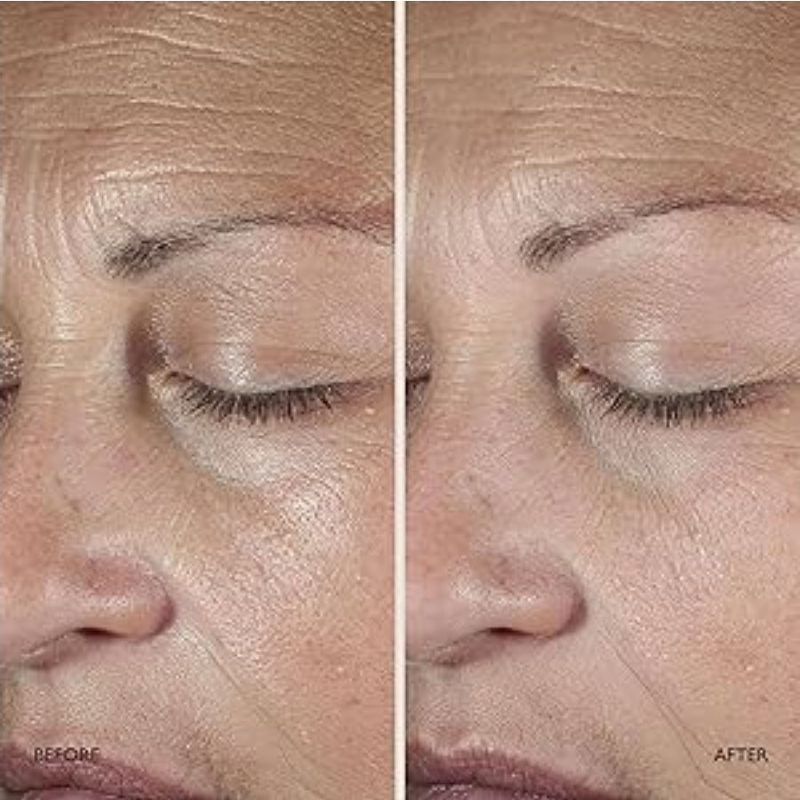 Omorovicza Queen Serum - Retinoid Facial Serum with Mediterranean Microalgae, Lithops Stem Cells & Chinese Leaf Extract to Reduce Wrinkles, Firm & Smooth Skin