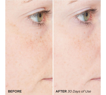 BeautyBio The Nightly - Suero reparador de retinol de noche reafirmante y suavizante