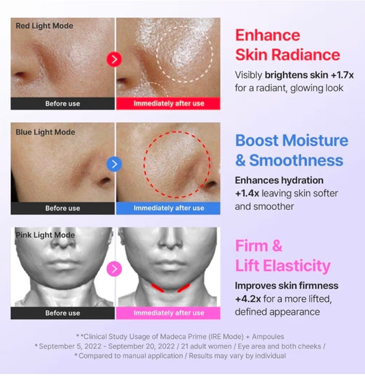 Centellian 24 Madeca Prime - Facial Toning Device - 3-in-1, Glowing Glass Skin, Better Absorption, Ultra Light. Microcurrent