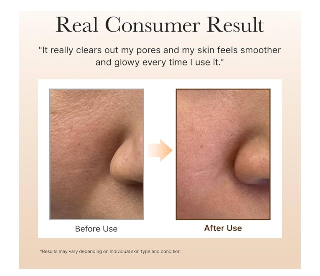 Arencia Calendula Rice Mochi Fresh Cleanser - Moisturizing, Brightening & Deep-Cleansing for Sensitive Skin