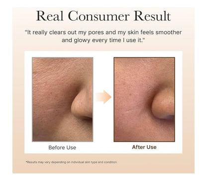 Arencia Calendula Rice Mochi Fresh Cleanser - Moisturizing, Brightening & Deep-Cleansing for Sensitive Skin