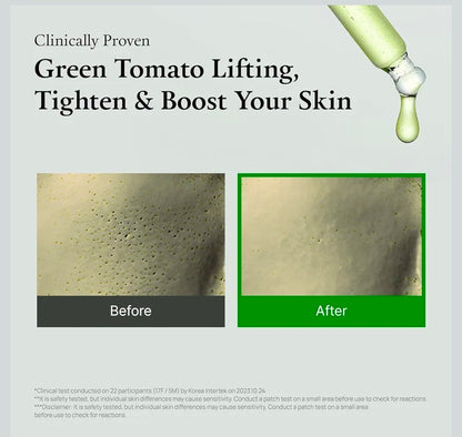 FULLY Green Tomato Serum - Pore Tightening with 67% Green Tomato Extract, Vit C and PHA, Elasticity Boosting and Skin Moisturization, Fragrance Free, Vegan