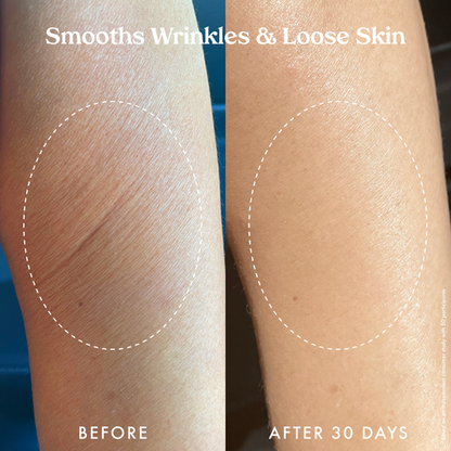Kopari Ultra Renewal Retinol Body Cream, Infused with Acai & Encapsulated Retinol - Treats fine lines, sun damage & crepey skin