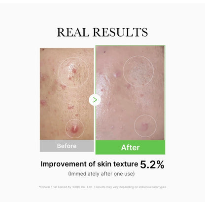 Medicube-Exosome Cica Serum - Enriquecido con 12 tipos de ingredientes de Cica y 2% de niacinamida, ofrece un efecto calmante para la piel irritada e ilumina la piel oscura.