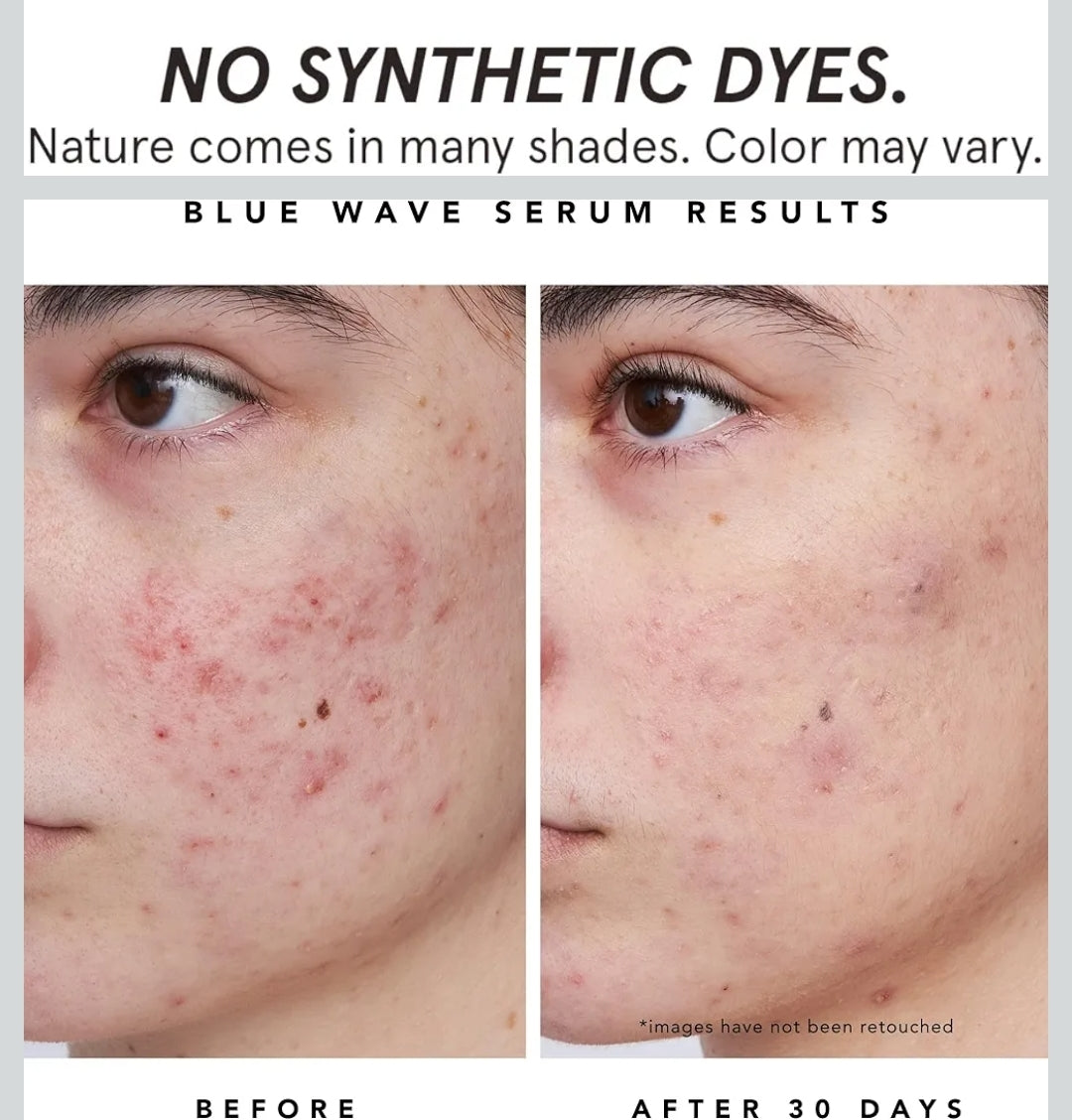 HERBIVORE Blue Besties Duo – 2 Step Treatment for Acne-Prone Skin - Aquarius Cleanser (50 mL) & Blue Wave Serum (10 mL), Plant-Based, Vegan, Cruelty-Free