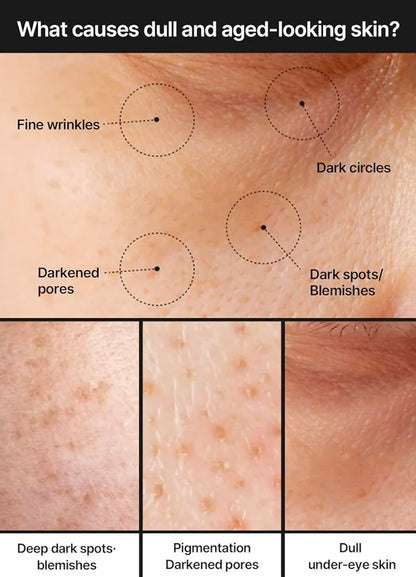Crema iluminadora Celimax Pore+ Dark Spot: con niacinamida, ácido tranexámico y TXA, minimizadora de poros, no irritante, hidratante, para piel sensible.