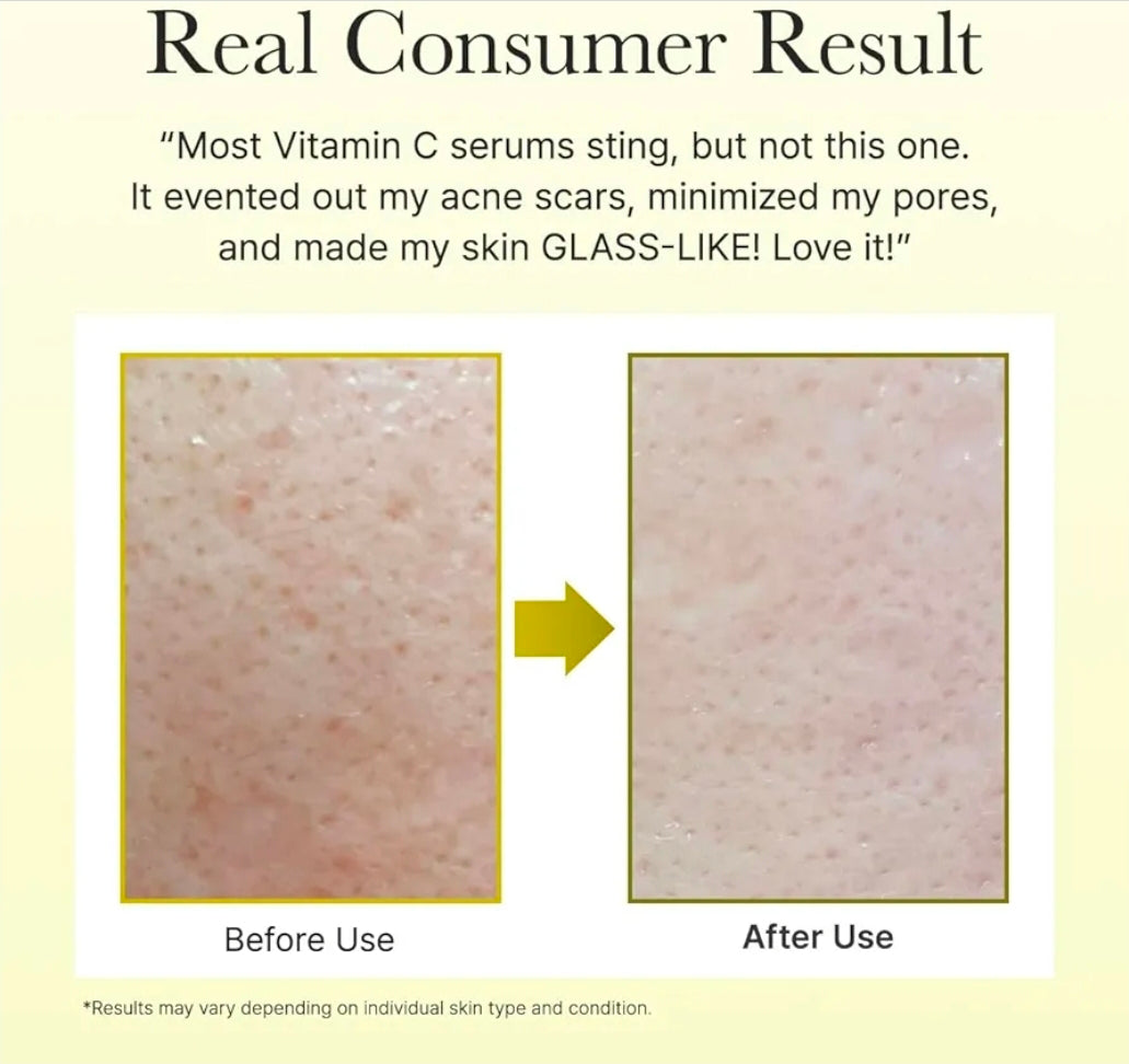 Arencia Vitamin C Booster Shot Serum - With Glutathione, Niacinamide and Vitamin E for Dark Spot Care, Fine Lines & Wrinkles, Glass Skin