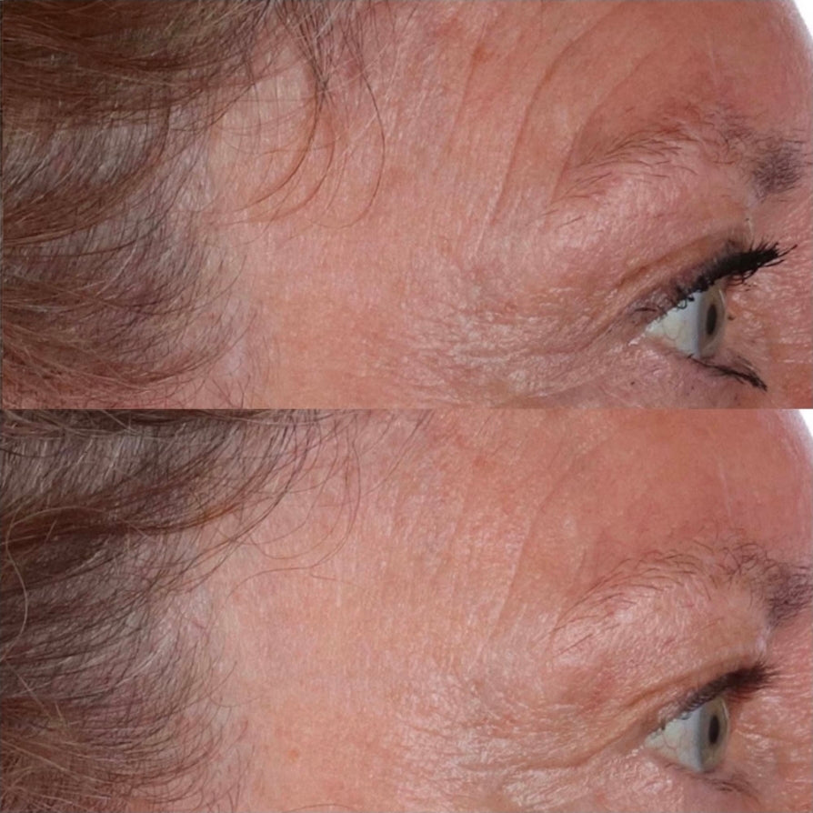 Perricone MD Cold Plasma Plus+ The Essence - Fast Absorbing & Intensely Hydrating Lightweight Treatment - Leaves skin smooth, plump & revitalized, Improves loss of radiance, uneven texture & tone