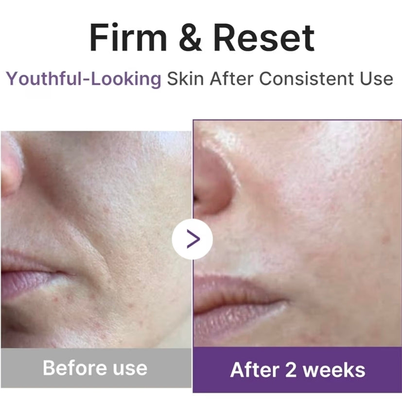 medicube Retinol Boosting Serum - Intensive Firming, Hydration & Plumping Care with Retinol, Peptides & Vitamins, Pore-Refining, Smooth Radiant Skin