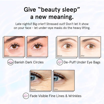 Grace & Stella Retinol Under Eye Patches - Gel Eye Mask with Hyaluronic Acid - For Puffiness, Brightening, Rejuvenating, Dark Circles, Hydrating, Moisturizing - 1 Pair