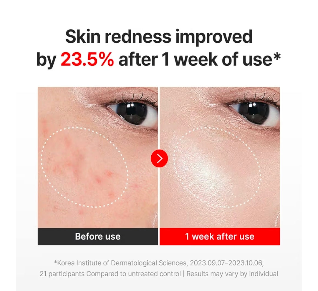 CENTELLIAN 24 Madeca Cream Time Reverse: la crema antienvejecimiento avanzada está diseñada para combatir 10 signos de problemas de la piel, como líneas finas, arrugas, firmeza, tono de piel desigual y opacidad.