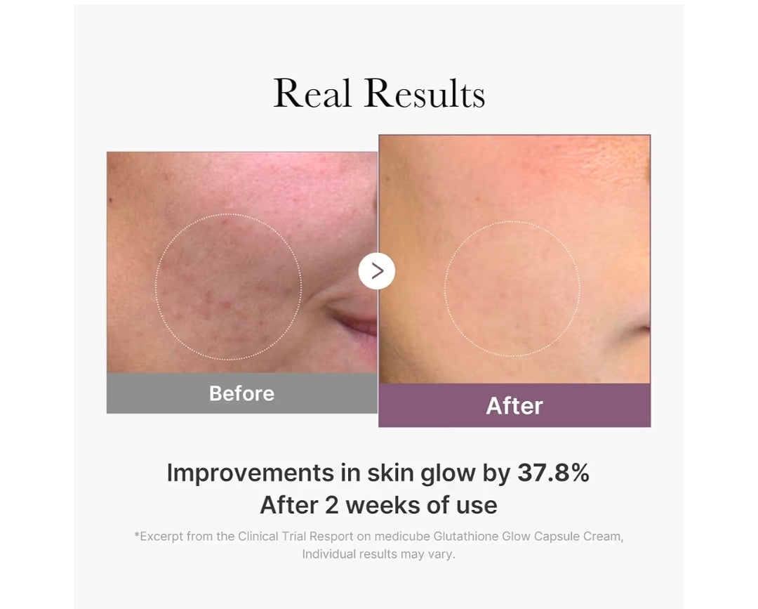 medicube AGE-R Glutathione Glow Capsule Facial Cream - Instant Lifting Moisturizer - Collagen Peptide For Hydrating Glow - Improve Blemishes, Uneven Skin Tone