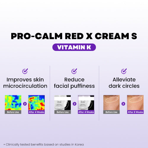 Hanmi PRO-CALM Vitamin-K Red X Cream  Derma Calming Cream for Redness & Irritation | CICA-Based Soothing Moisturizer for Sensitive Skin & Barrier Support | Hypoallergenic