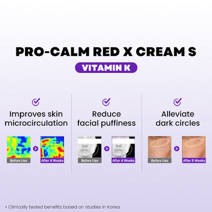 Hanmi PRO-CALM Vitamin-K Red X Cream  Derma Calming Cream for Redness & Irritation | CICA-Based Soothing Moisturizer for Sensitive Skin & Barrier Support | Hypoallergenic